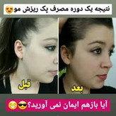 خرید عمده 20عددی تونیک رشد مو اصل تضمینی ۳۰۰ میل ارسال مستقیم از شرکت ایرانیان زمین