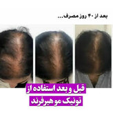 خرید عمده 20عددی تونیک رشد مو اصل تضمینی ۳۰۰ میل ارسال مستقیم از شرکت ایرانیان زمین