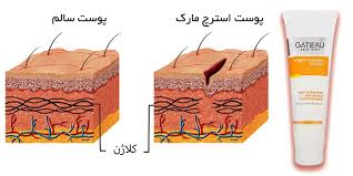 کرم کلاژن ساز پوست شکم گاتیو ایتالیا 100 میل