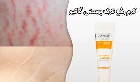 کرم رفع ترک های پوستی ناشی از بارداری گاتیو ایتالیا 100 میل
