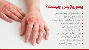 کرم کمک به رفع پسوریازیس ویتامین E و آلوئه ورا ویتابلا اصل ضمانتی مستقیم از شرکت ایرانیان زمین