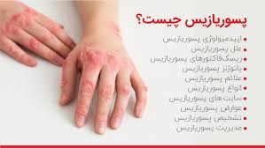 کرم درمان پسوریازیس با کمک کرم ویتامین E و آلوئه ورا ویتابلا اصل ضمانتی مستقیم از شرکت ایرانیان زمین