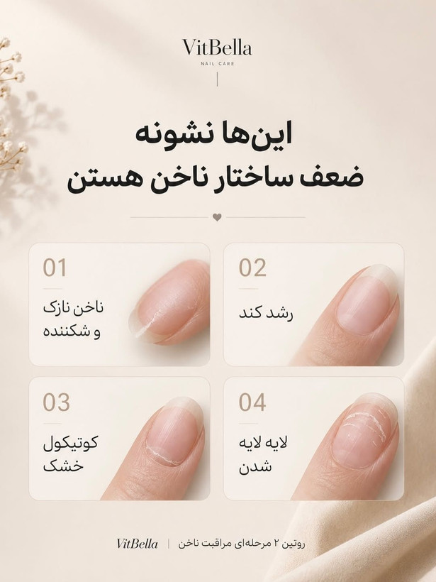 سرم دوفاز تقویت ناخن و کوتیکول با رایحه Lamour ویتابلا