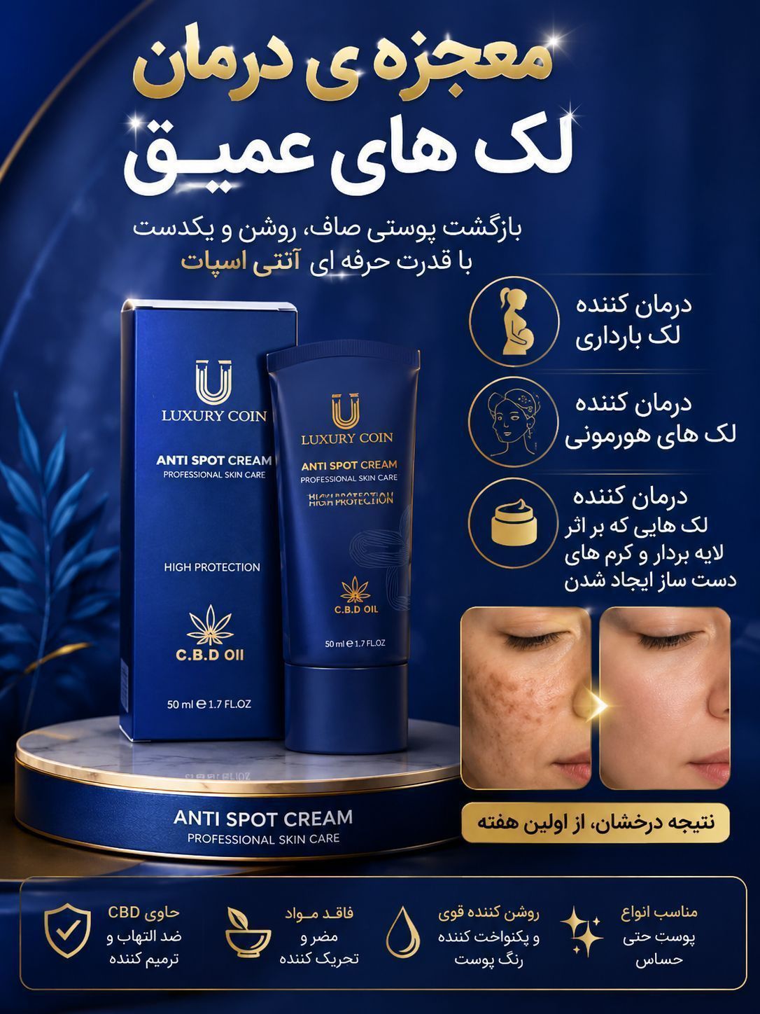 کرم بیوممتیک رفع لک های بارداری و پر رنگ قهوه ای  برند لاکچری کوین فرانسه اصل 50میل