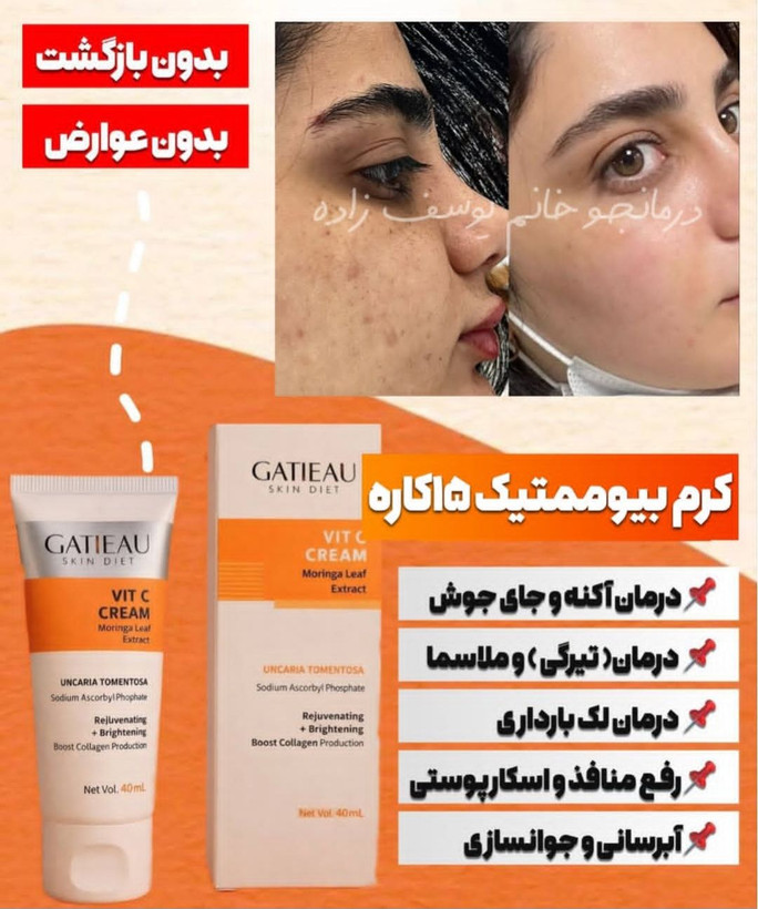 کرم بیوممتیک ضد لک جهانی کلاژن ساز جوانساز گاتیو ایتالیا