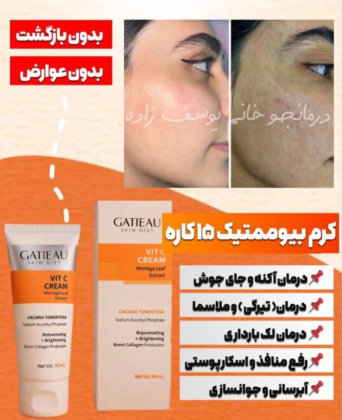 کرم بیوممتیک ضد لک جهانی کلاژن ساز جوانساز ضد پیری پوست گاتیو ایتالیا